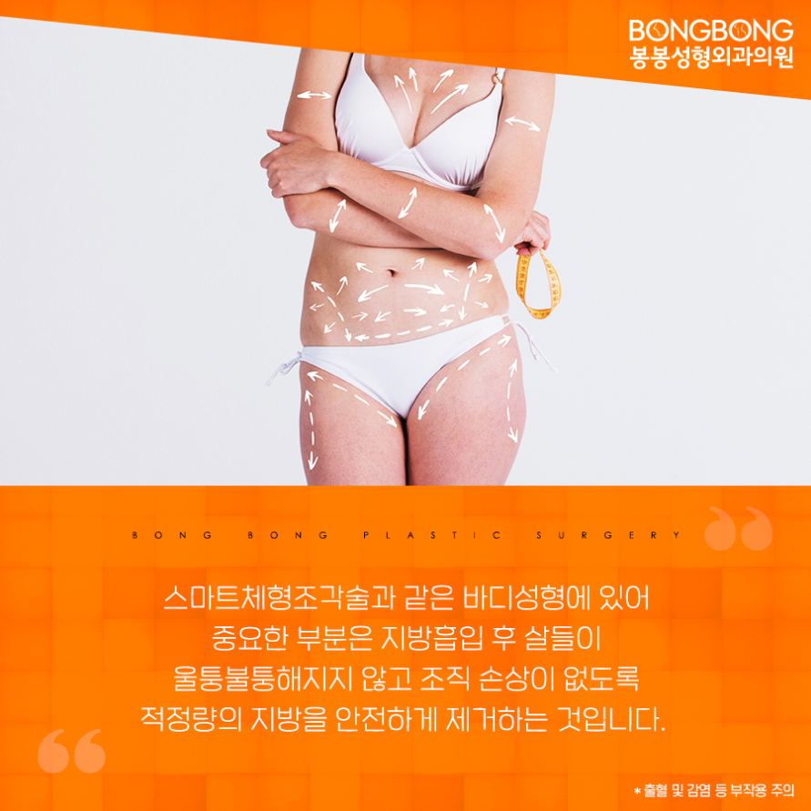 허리라인이 잘록한 코르셋라인으로, 봉봉 [스마트체형조각술] 관련 이미지 6
