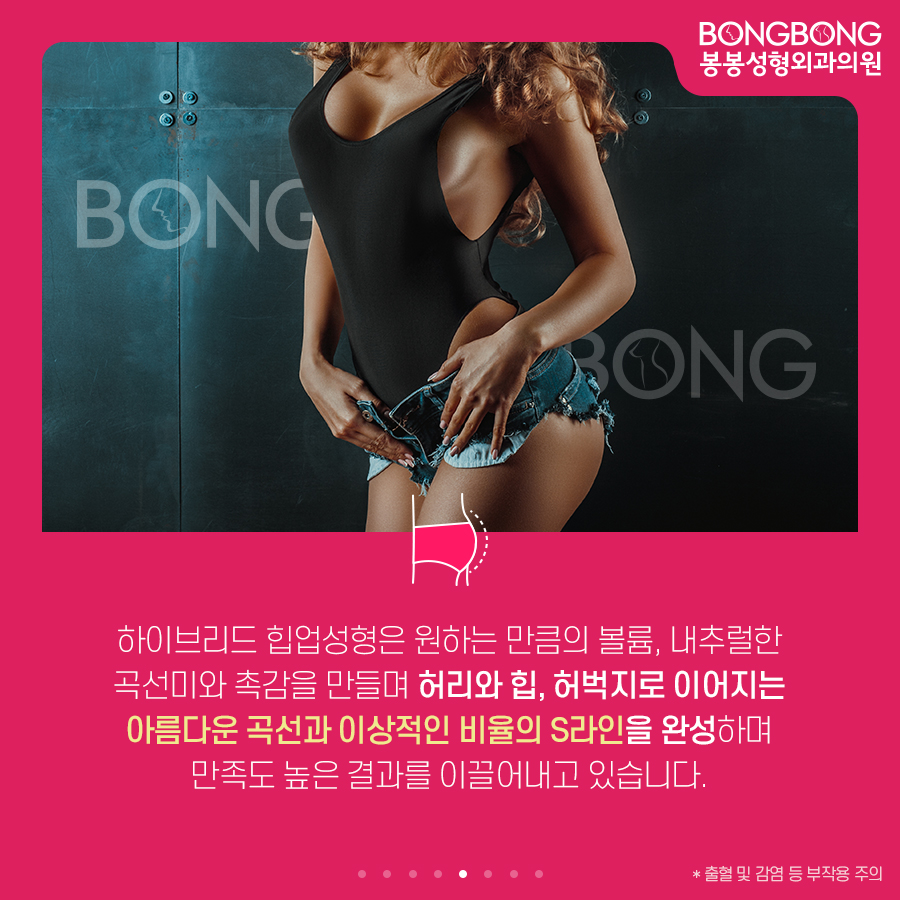 하이브리드 힙업성형방법, 세계최초 개발한 봉봉성형외과 관련 이미지 5