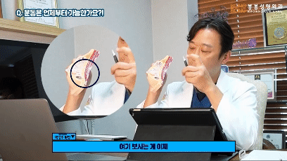 가슴성형 후 운동 언제부터? 관련 이미지 3