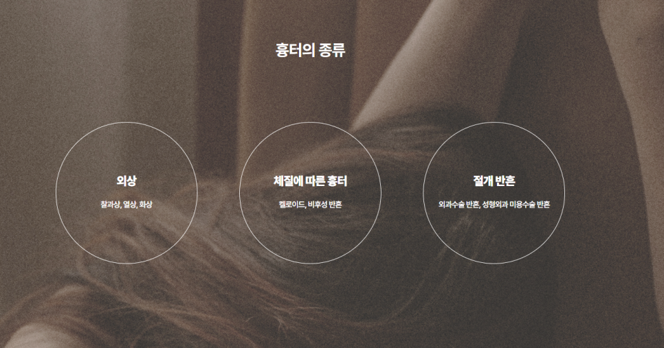흉터레이저치료 튼살 피부재생 탄력까지! 강남 #봉봉성형외과 관련 이미지 2