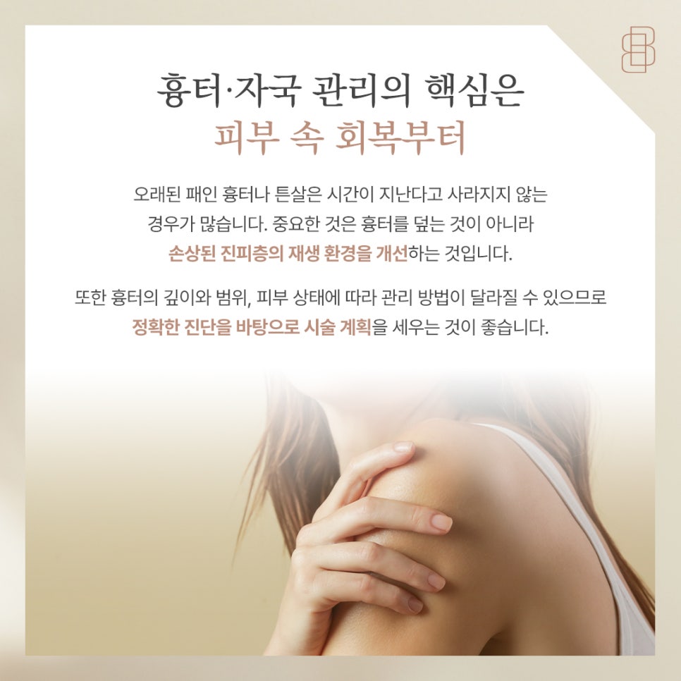 미라젯 흉터 케어 가이드 오래된 패인 자국 진피층 재생으로 말끔하게 관련 이미지 5