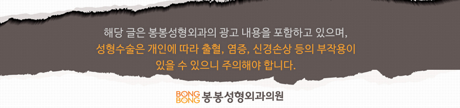 모티바보형물에 봉봉성형외과의 노하우를 더하면!? 관련 이미지 13