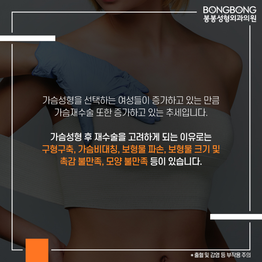 가슴성형 후 구형구축 [가슴재수술] 고려사항은? 관련 이미지 2