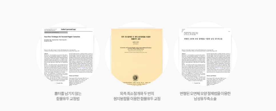 함몰유두성형 유륜미백으로 말 못할 고민 해결! 봉봉성형외과 관련 이미지 3