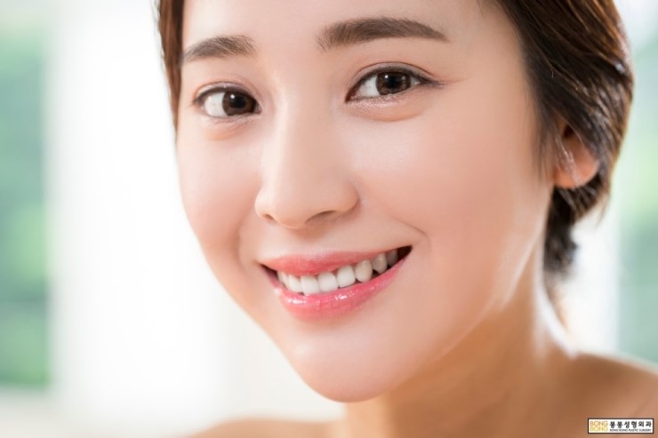 눈성형수술, 만족스러운 봉봉성형외과에서 눈성형종류 알아보자! 관련 이미지 2