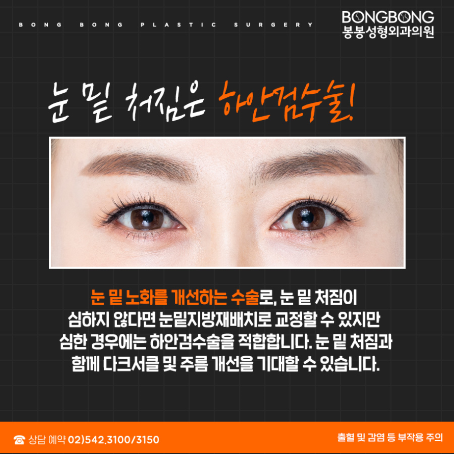 어버이날 효도성형, 상하안검수술 어디가 좋을까? 관련 이미지 5