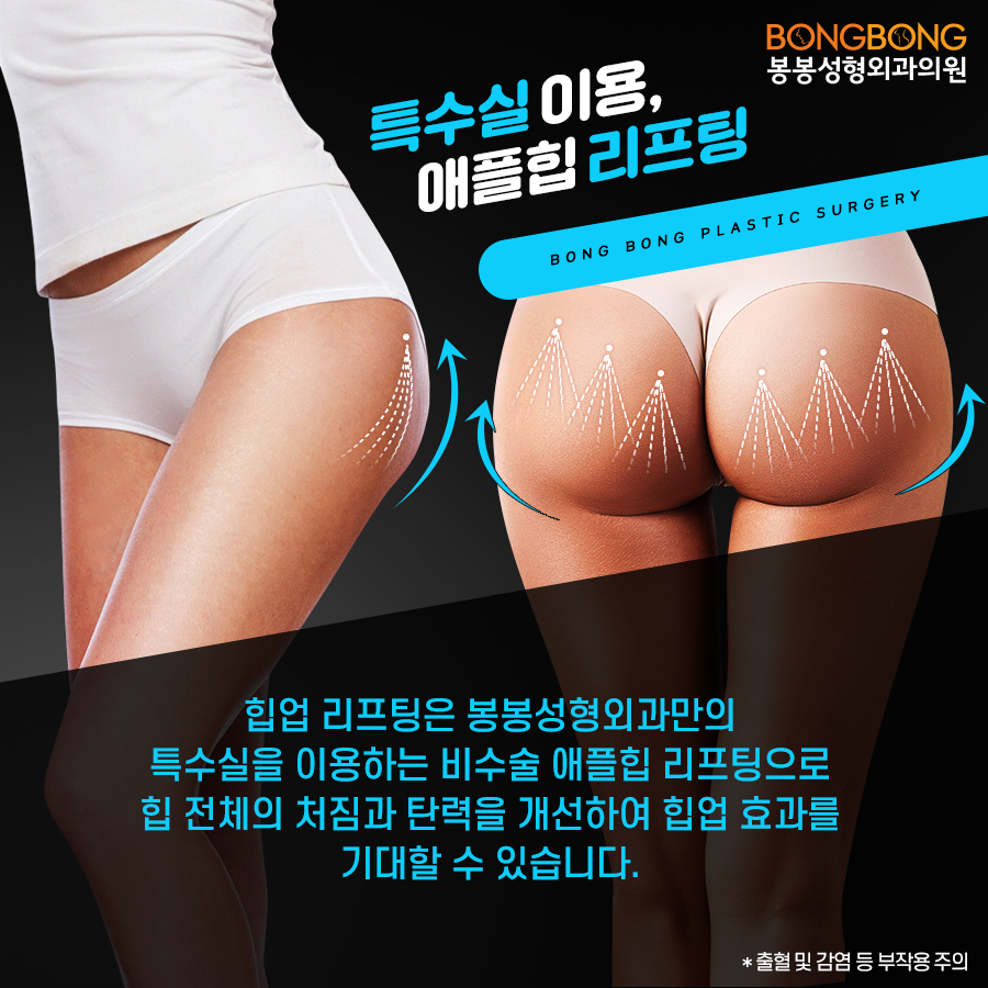 애플힙만들기, 운동 말고 봉봉 관련 이미지 5