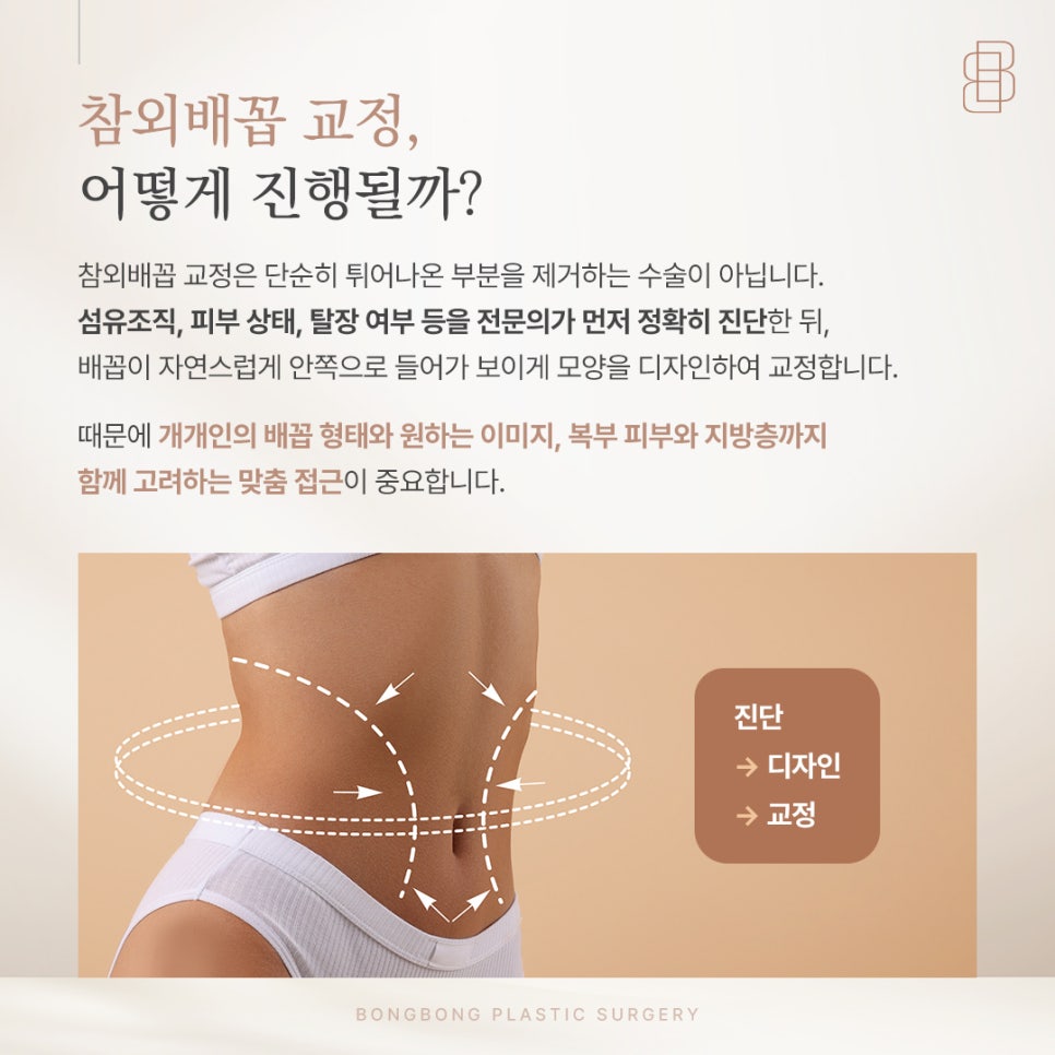 튀어나온 참외배꼽이 고민이라면? 흉터 걱정 줄인 교정 노하우 관련 이미지 3