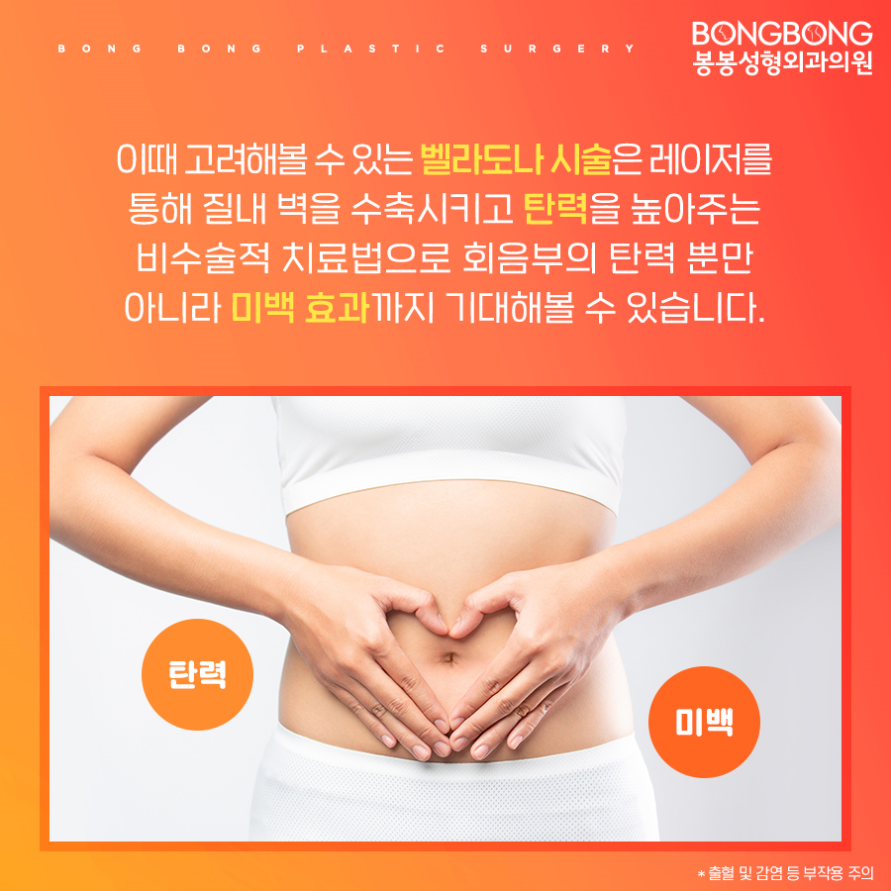 여성수술이 부담된다면, 벨라도나 레이저 시술은 어때? 관련 이미지 3