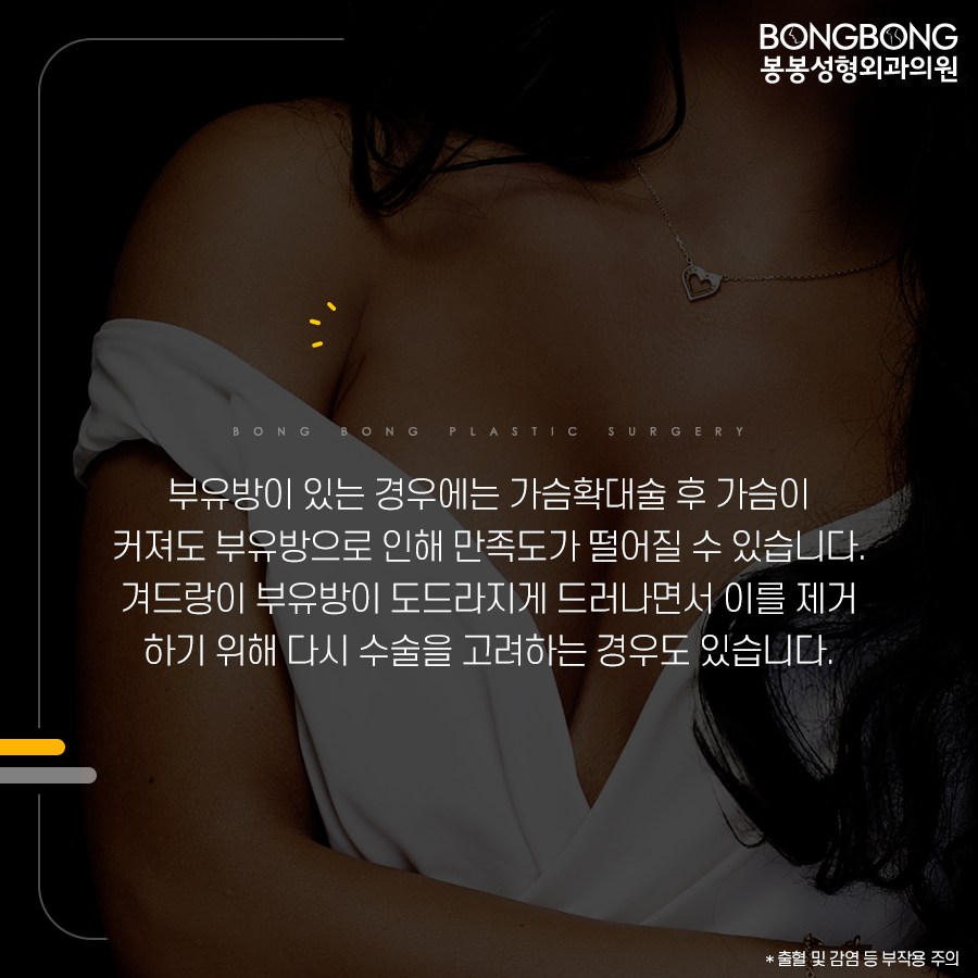 가슴성형과 부유방제거, 동시에 해야 하는 이유는? 관련 이미지 3