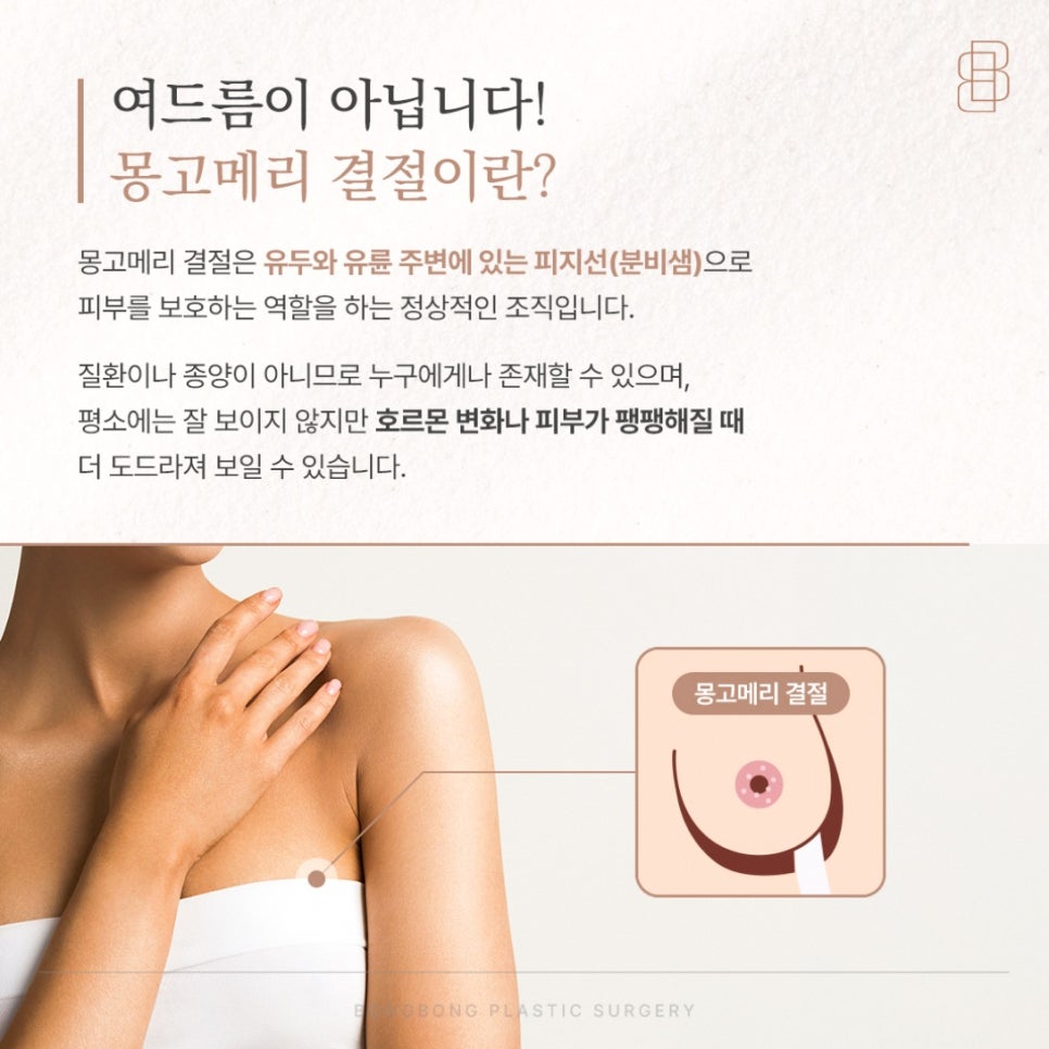 몽고메리결절 유두 유륜 정상 범위와 제거를 결정하는 기준 4가지 관련 이미지 2