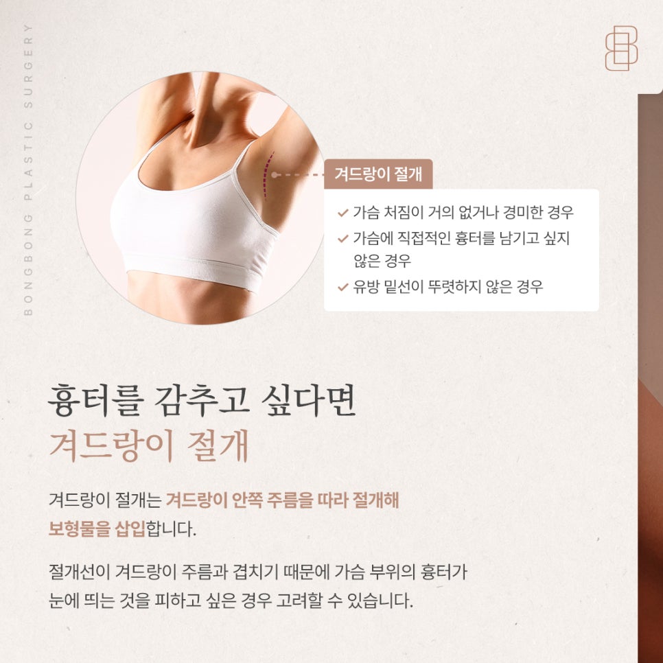 회복 빠른 밑선 vs 흉터 감추는 겨드랑이, 나에게 맞는 가슴성형 절개방법은? 관련 이미지 3