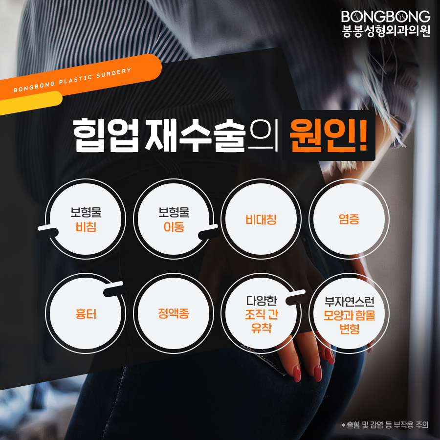힙업성형 후 부작용, 봉봉에서 안전하게 재수술로! 관련 이미지 4
