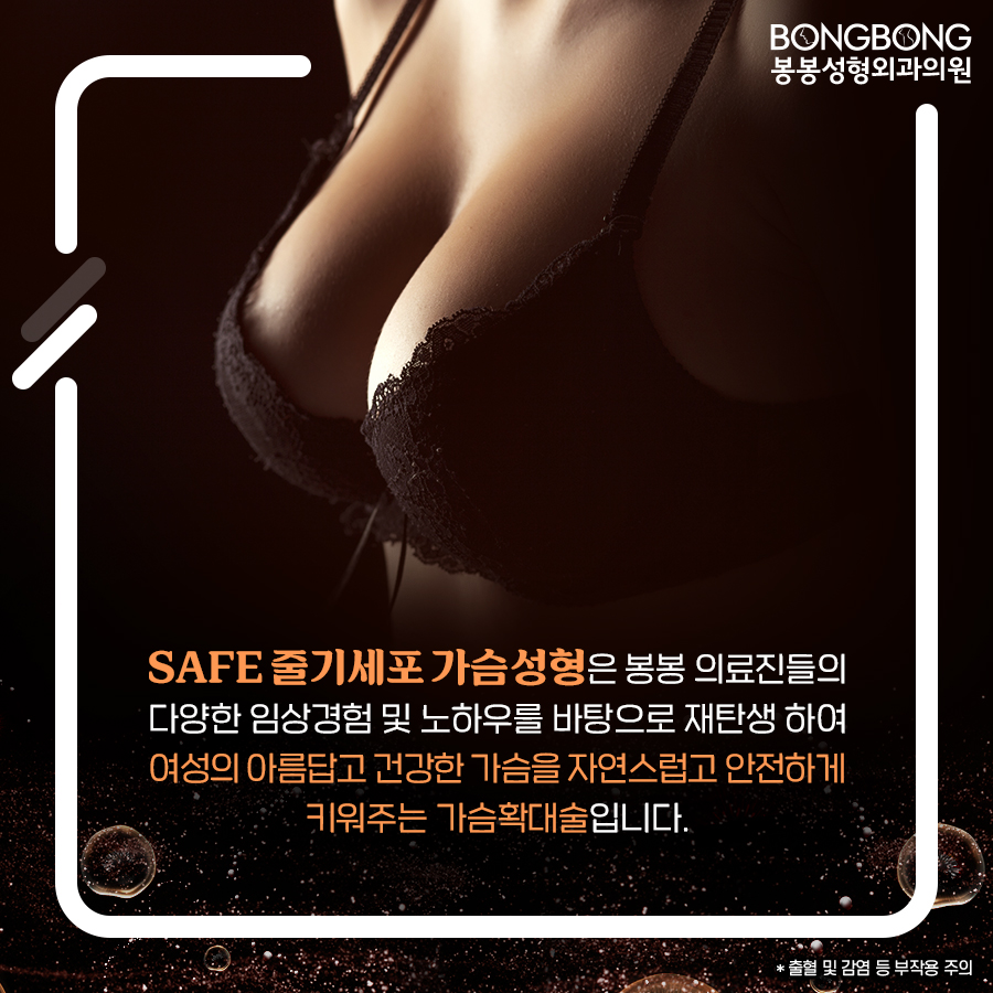 가슴볼륨 및 지방흡입 두 마리 토끼 잡을 수 있는 봉봉성형외과의 SAFE줄기세포가슴성형 관련 이미지 2