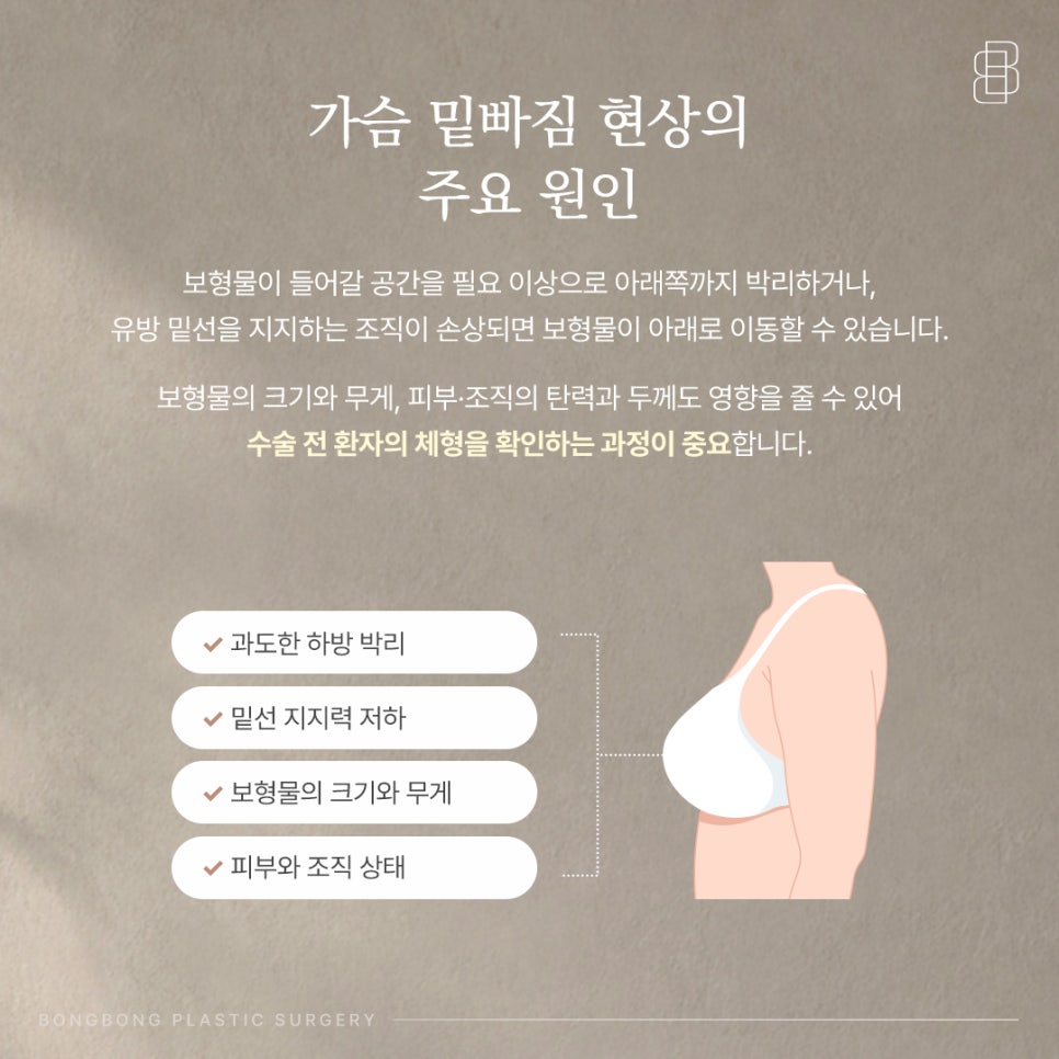 가슴 밑빠짐 모양 원인은? 보형물 공간을 딱 맞게 만들어야 하는 이유 관련 이미지 3