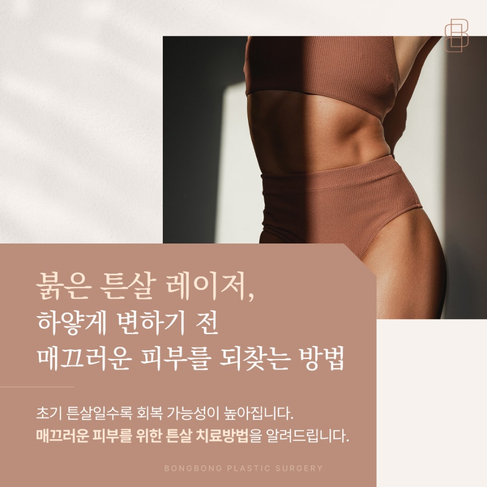 붉은 튼살 레이저 하얗게 변하기 전 매끄러운 피부를 되찾는 방법 관련 이미지 1