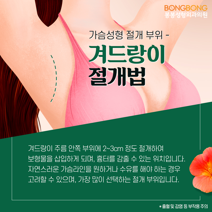 강남가슴성형 흉터걱정 지우고 싶다면? 관련 이미지 3