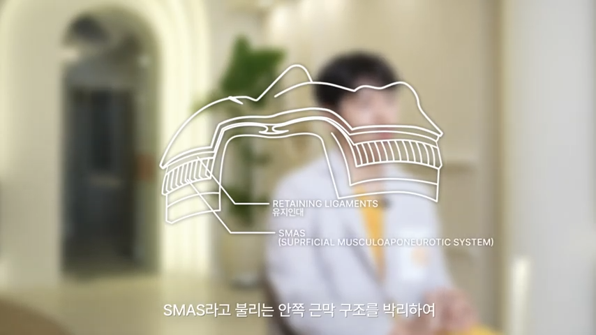 실리프팅 하기 전에 꼭 보세요! 봉봉에서 알려드리는 리프팅의 모든 것! 관련 이미지 11