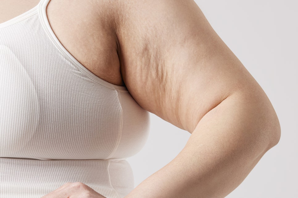붉은튼살 레이저 치료 주사 바늘 없는 미라젯이란? 관련 이미지 1