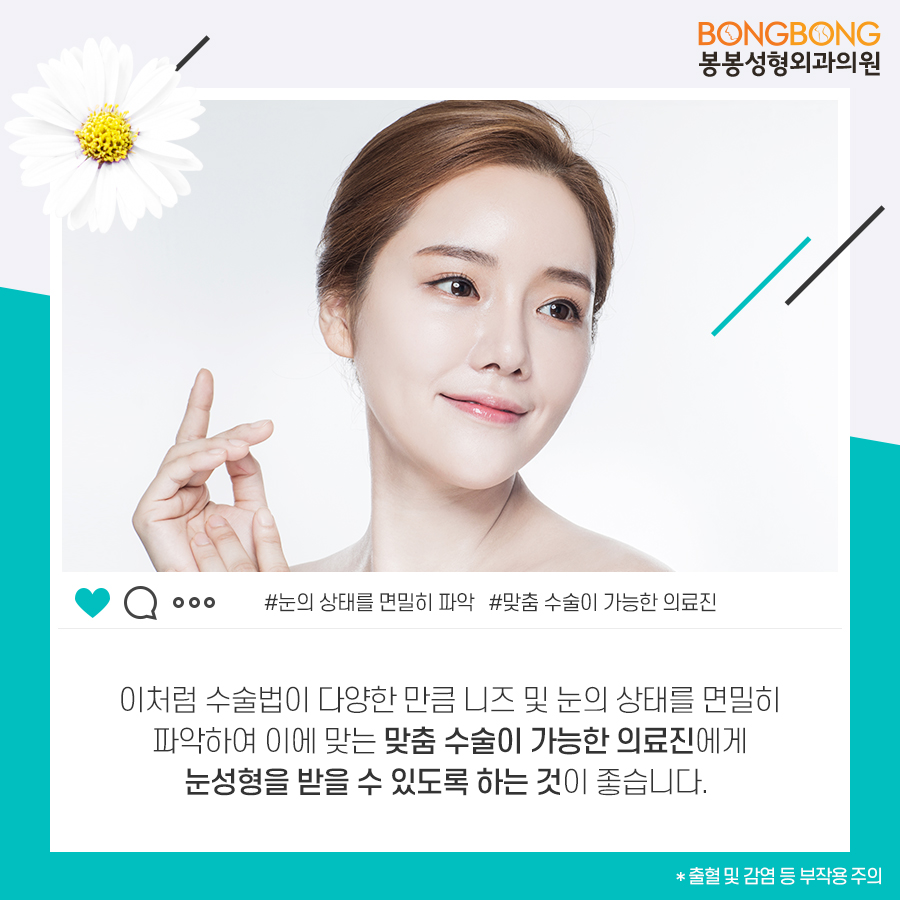 눈성형종류 중 내게 맞는 것 봉봉성형외과 관련 이미지 5