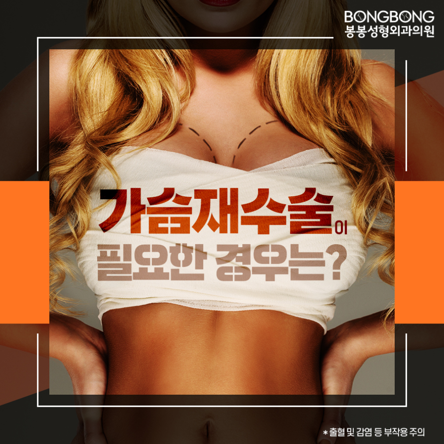 가슴성형 후 구형구축 [가슴재수술] 고려사항은? 관련 이미지 1