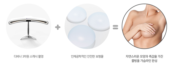 S라인 몸매? 봉봉성형외과 물방울가슴성형수술로 완성! 관련 이미지 5