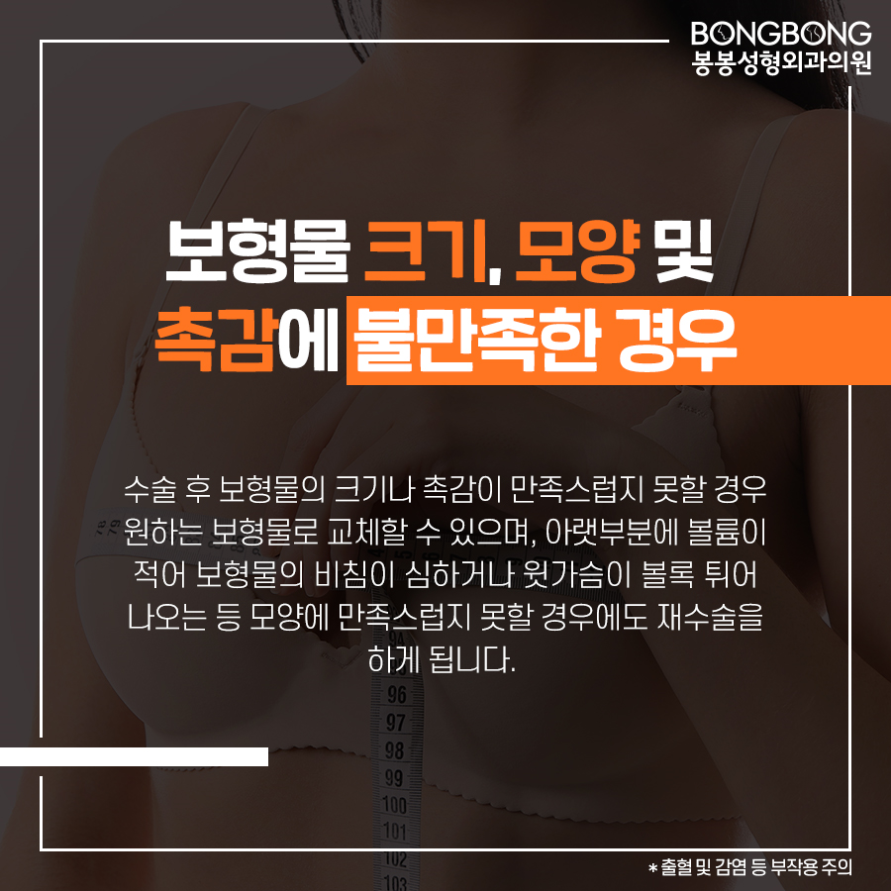 가슴성형 후 구형구축 [가슴재수술] 고려사항은? 관련 이미지 4