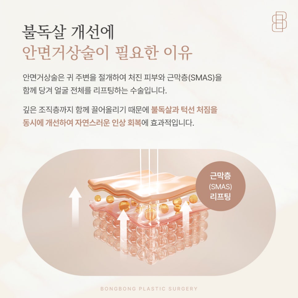 불독살 없애기 50대 처진 얼굴 끌어올리는 안면거상술 관련 이미지 4
