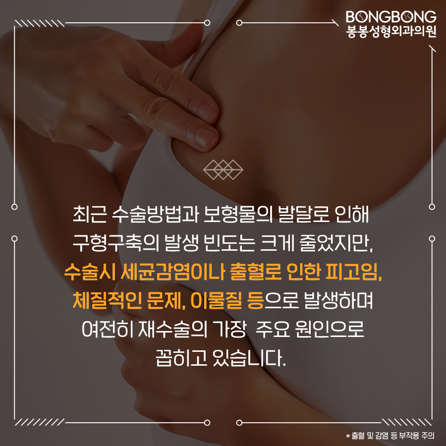 가슴재수술 더 이상 실패 안하려면 이것만 명심하세요 관련 이미지 7
