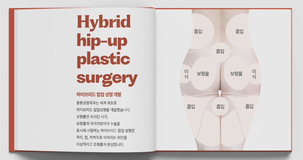 처진엉덩이밑살 하이브리드힙업성형으로 UP! 관련 이미지 6
