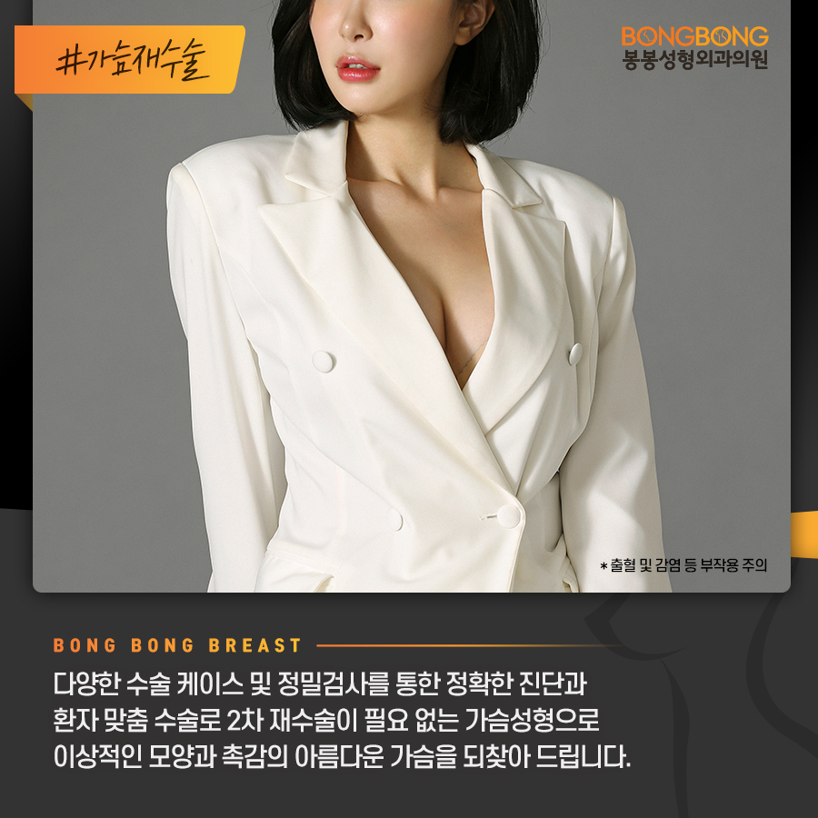 가슴성형! 의사의 숙련도와 보형물의 안정성 고려하세요! 관련 이미지 15