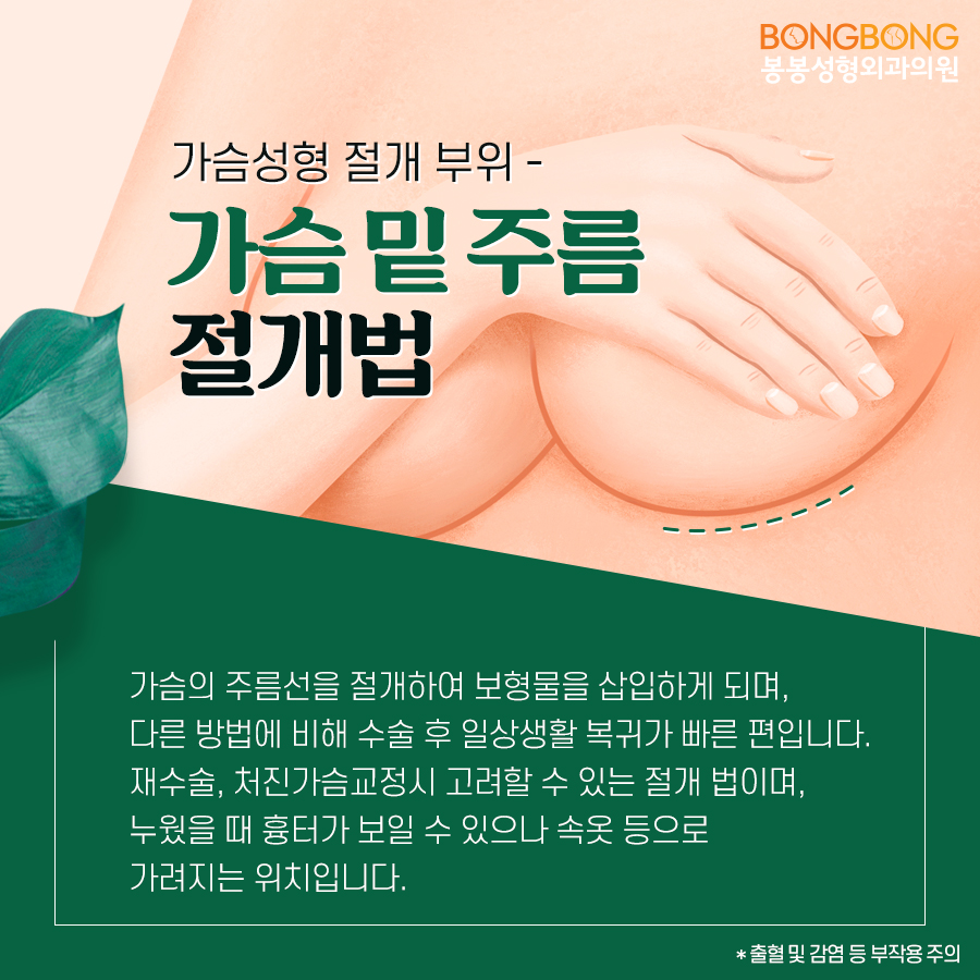 강남가슴성형 흉터걱정 지우고 싶다면? 관련 이미지 4
