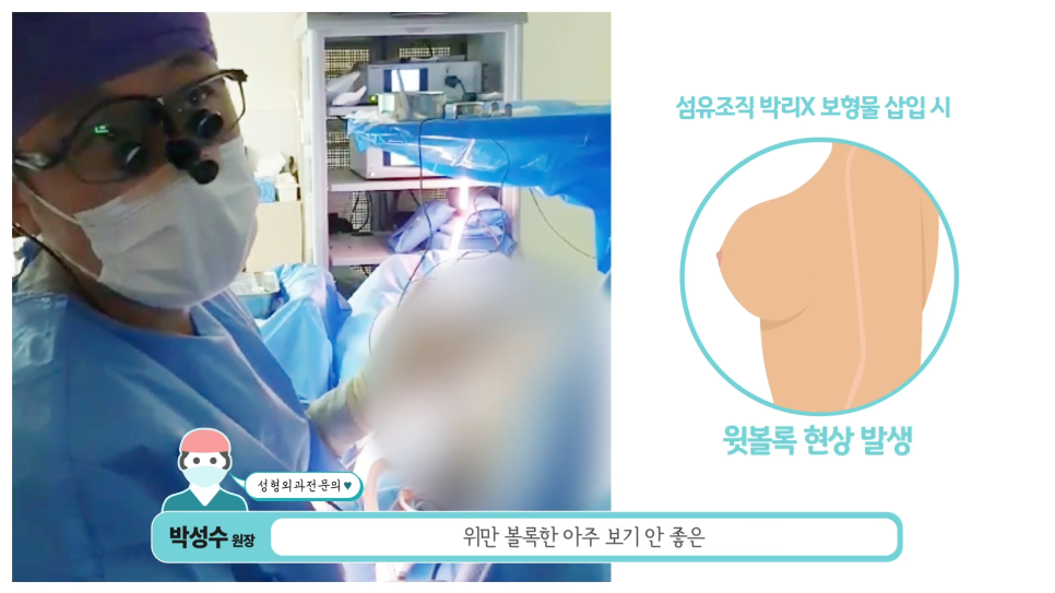 가슴성형수술, 내시경을 사용하는 이유는? 봉봉성형외과 관련 이미지 3