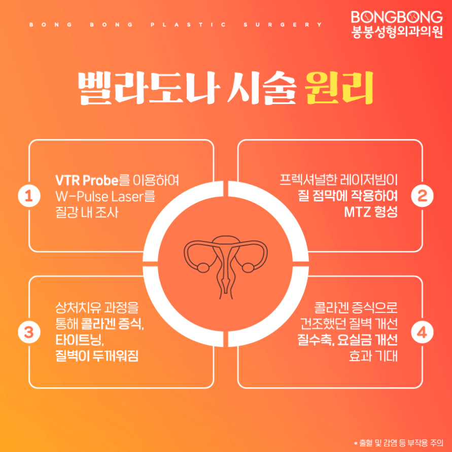 여성수술이 부담된다면, 벨라도나 레이저 시술은 어때? 관련 이미지 5