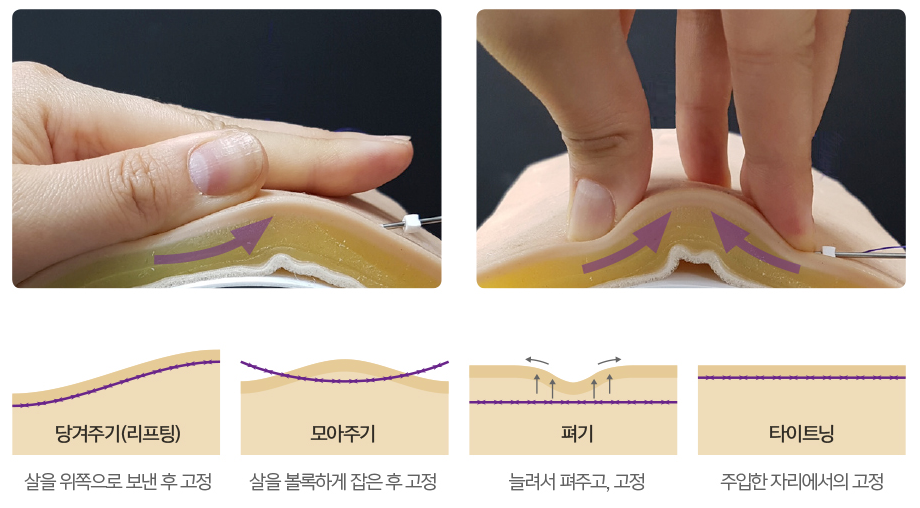 가슴볼륨리프팅 수술하지 말고 달라짐을 느껴보세요! 관련 이미지 5