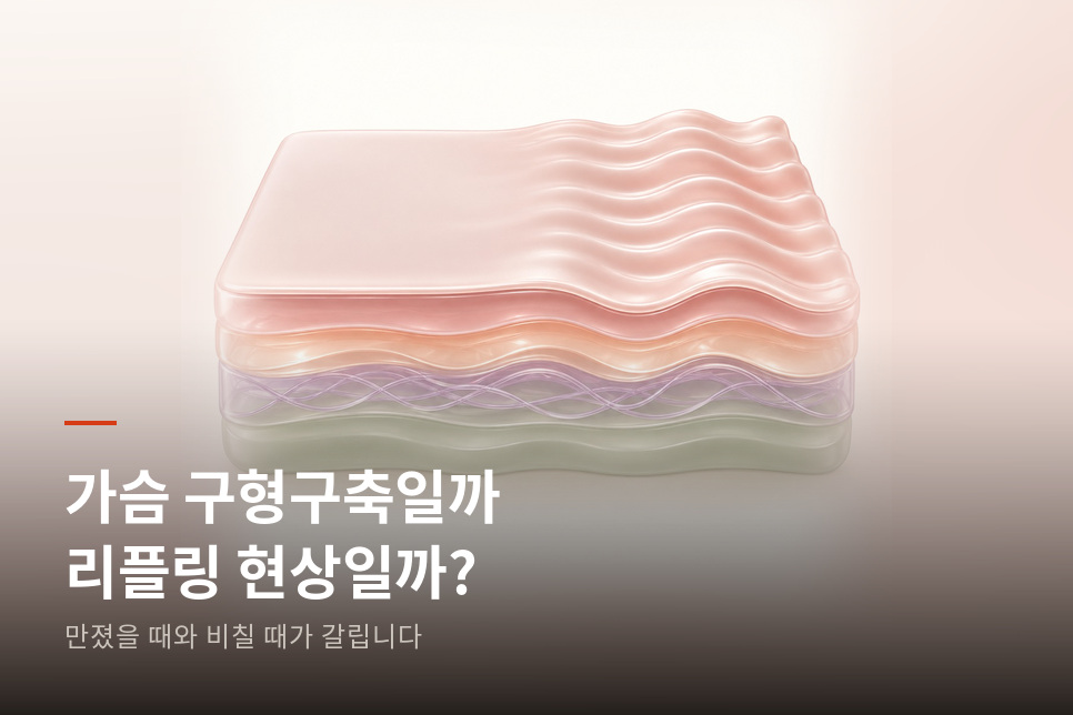 20년 뒤에도 몸에 남습니다 가슴 구형구축 리플링 현상이 알려주는 것 관련 이미지 1
