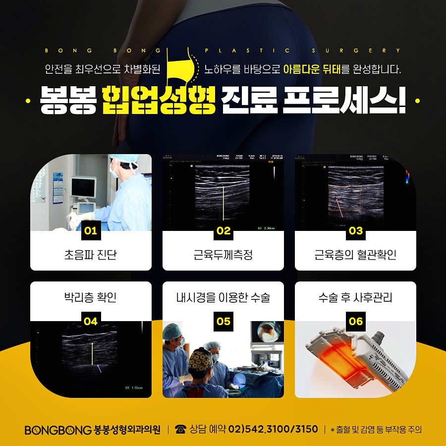 납작엉덩이 극복하는 힙업성형으로 애플힙 만들기 관련 이미지 14