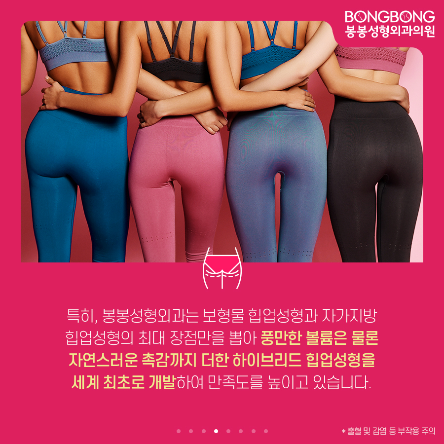 하이브리드 힙업성형방법, 세계최초 개발한 봉봉성형외과 관련 이미지 4