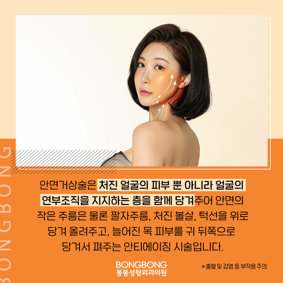자연스러운 주름개선, 안면거상술 효과가 궁금하면? 관련 이미지 4