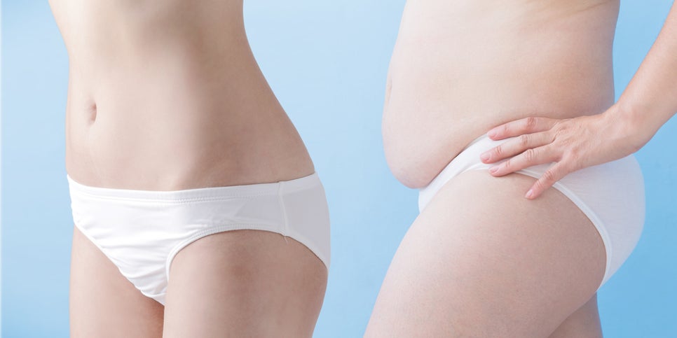 중년 이후 복부 처짐 원인과 관리 방법, 운동으로 해결이 어려운 이유는 관련 이미지 11