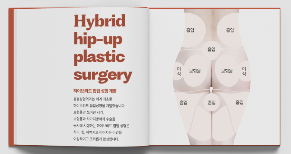 엉덩이 콤플렉스 성형 애플힙 #하이브리드힙업성형 으로! 관련 이미지 4