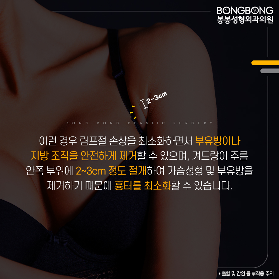 가슴성형과 부유방제거, 동시에 해야 하는 이유는? 관련 이미지 6