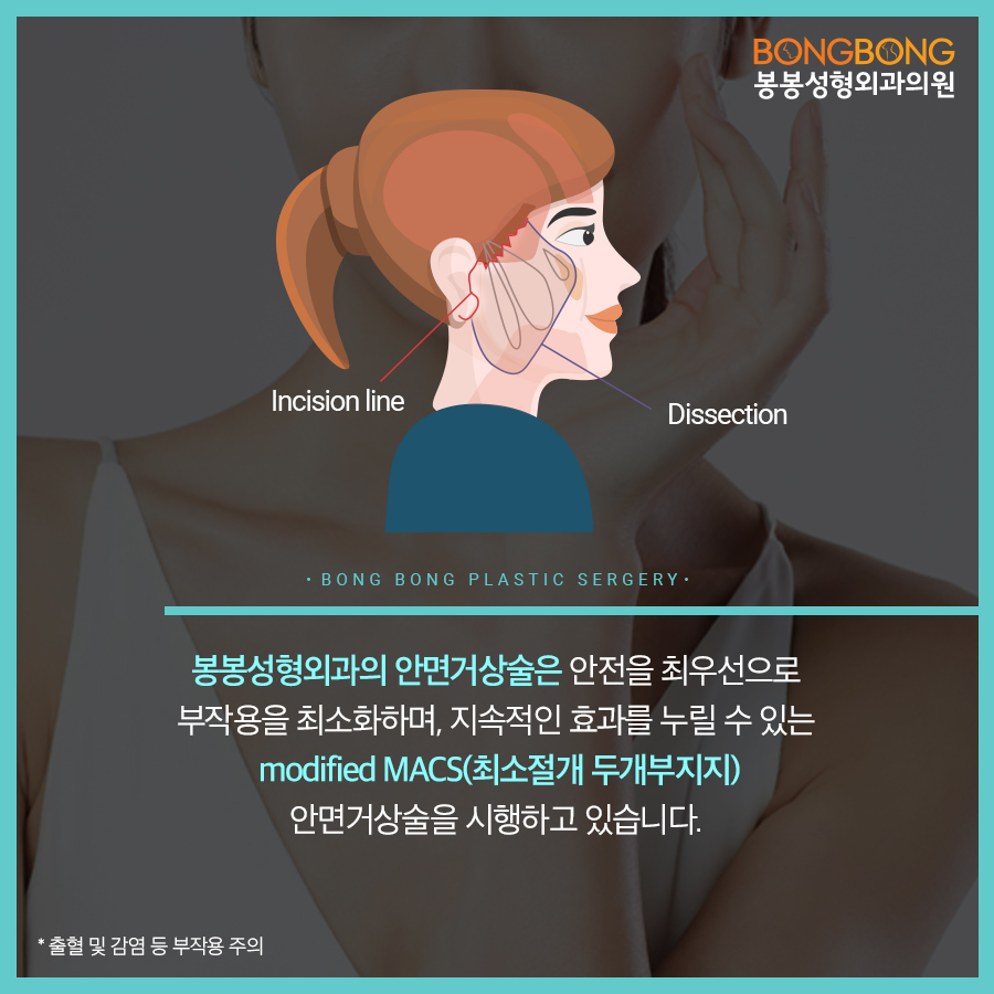 만족도 높은 안면거상효과? 학동역성형외과! 관련 이미지 3
