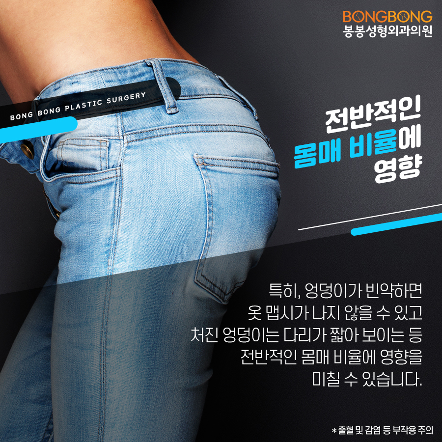 애플힙만들기, 운동 말고 봉봉 관련 이미지 3