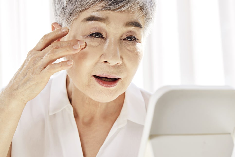 얼굴 주름살 제거, 안명거상술, 실리프팅 효과 관련 이미지 2