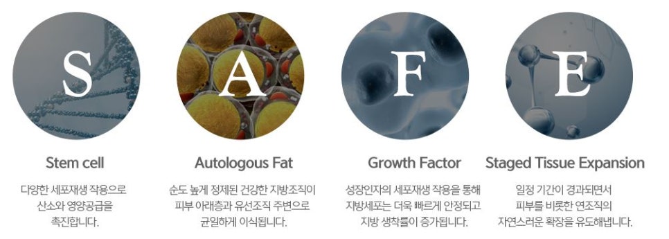 가슴확대술종류 중 줄기세포가슴성형이라고 아세요? 관련 이미지 6