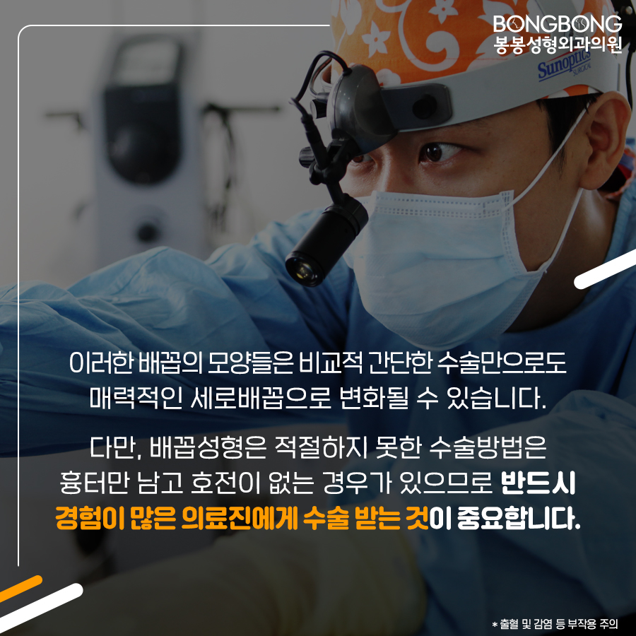참외배꼽 콤플렉스라면 봉봉성형외과의 배꼽성형 관련 이미지 6