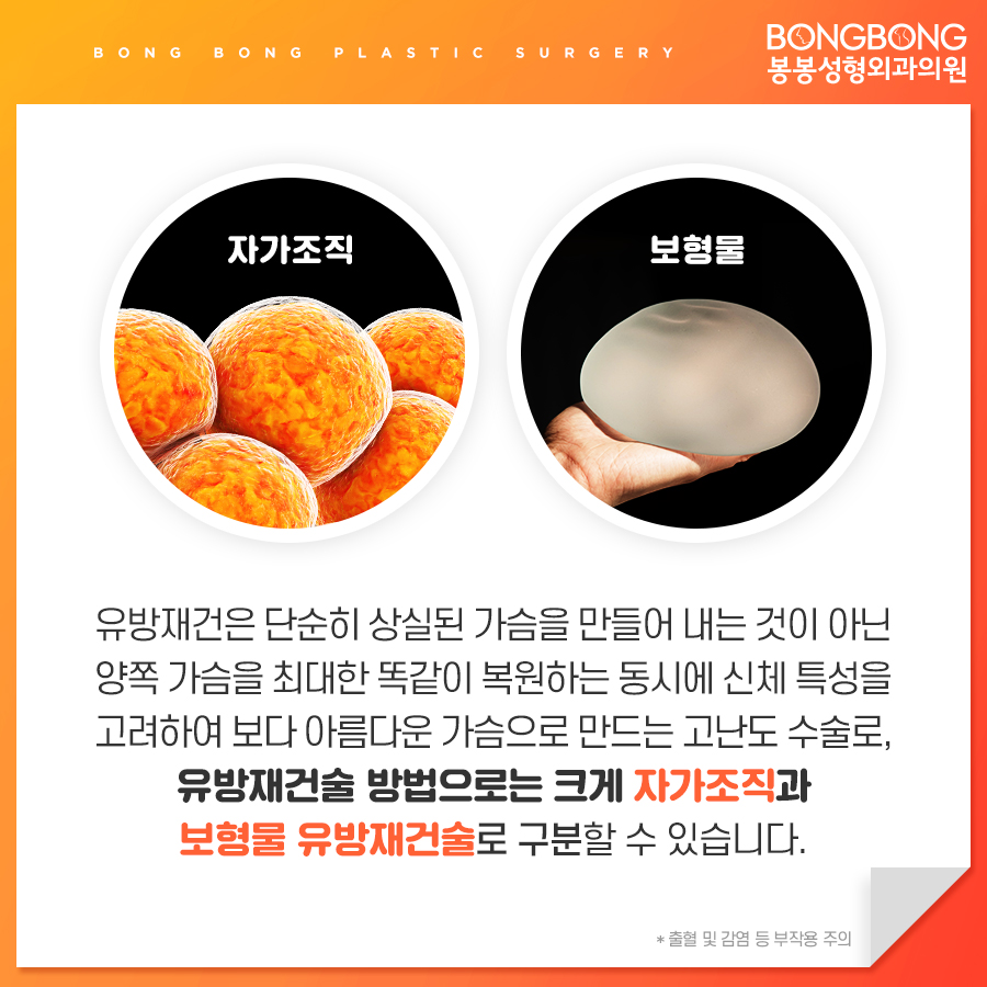 유방재건술방법 어떤 것이 있는지 봉봉성형외과에서 알려드림 관련 이미지 3