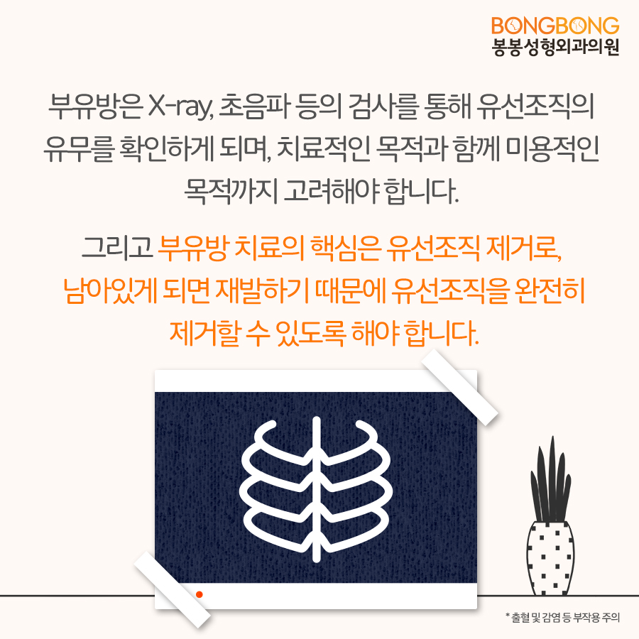 겨드랑이 부유방제거 오래 고민하고 있었다면 봉봉성형외과에서! 관련 이미지 4