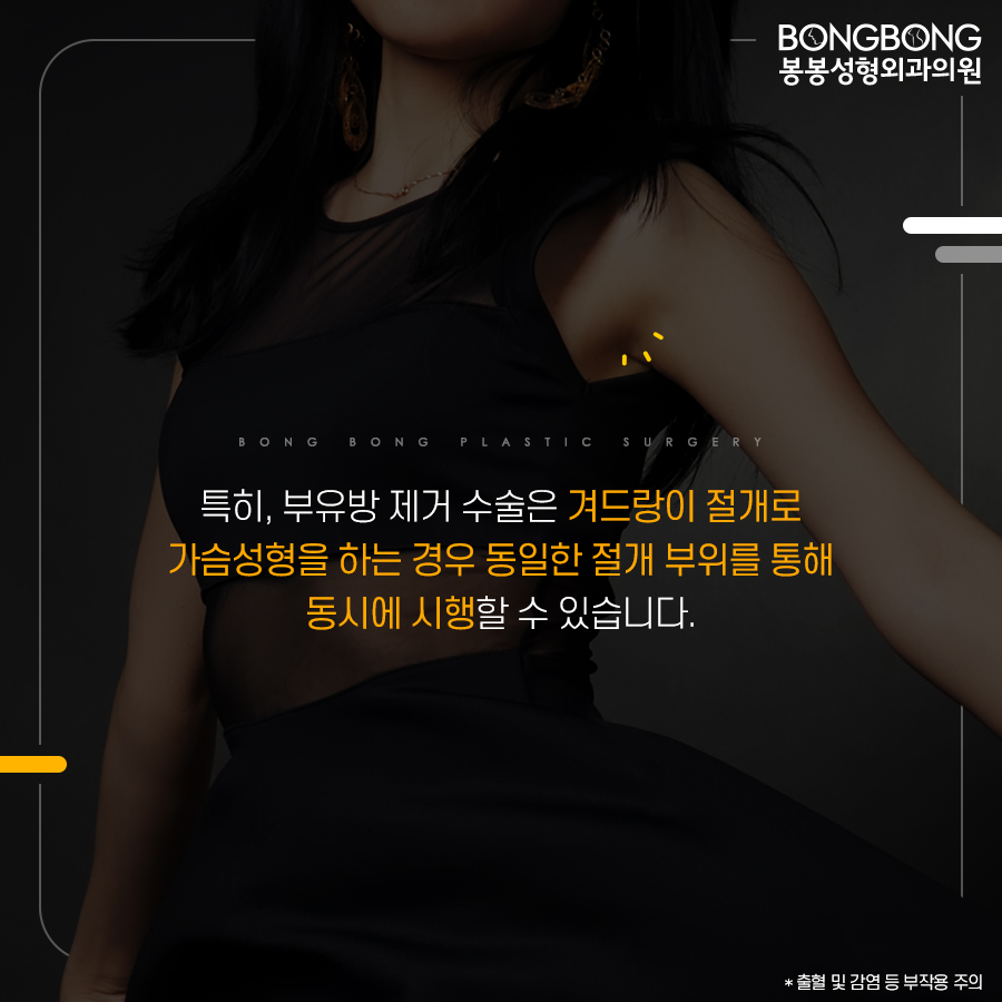 가슴성형과 부유방제거, 동시에 해야 하는 이유는? 관련 이미지 5